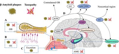 Olfactory deficit: a potential functional marker across the Alzheimer’s disease continuum